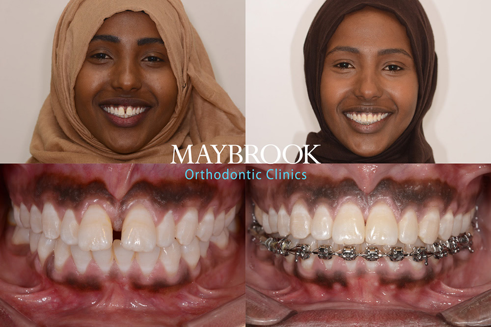 Luul testimonial for Maybrook Clinic